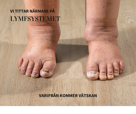Lymfvätskan – kroppens dolda reningsflöde