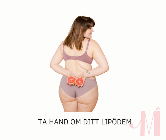 Lipödem - vad är det?