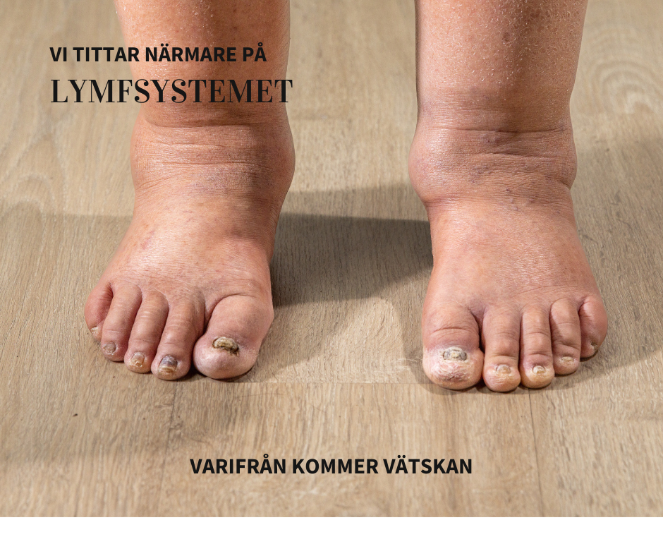 Lymfvätskan – kroppens dolda reningsflöde